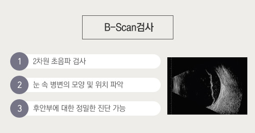 B-scan